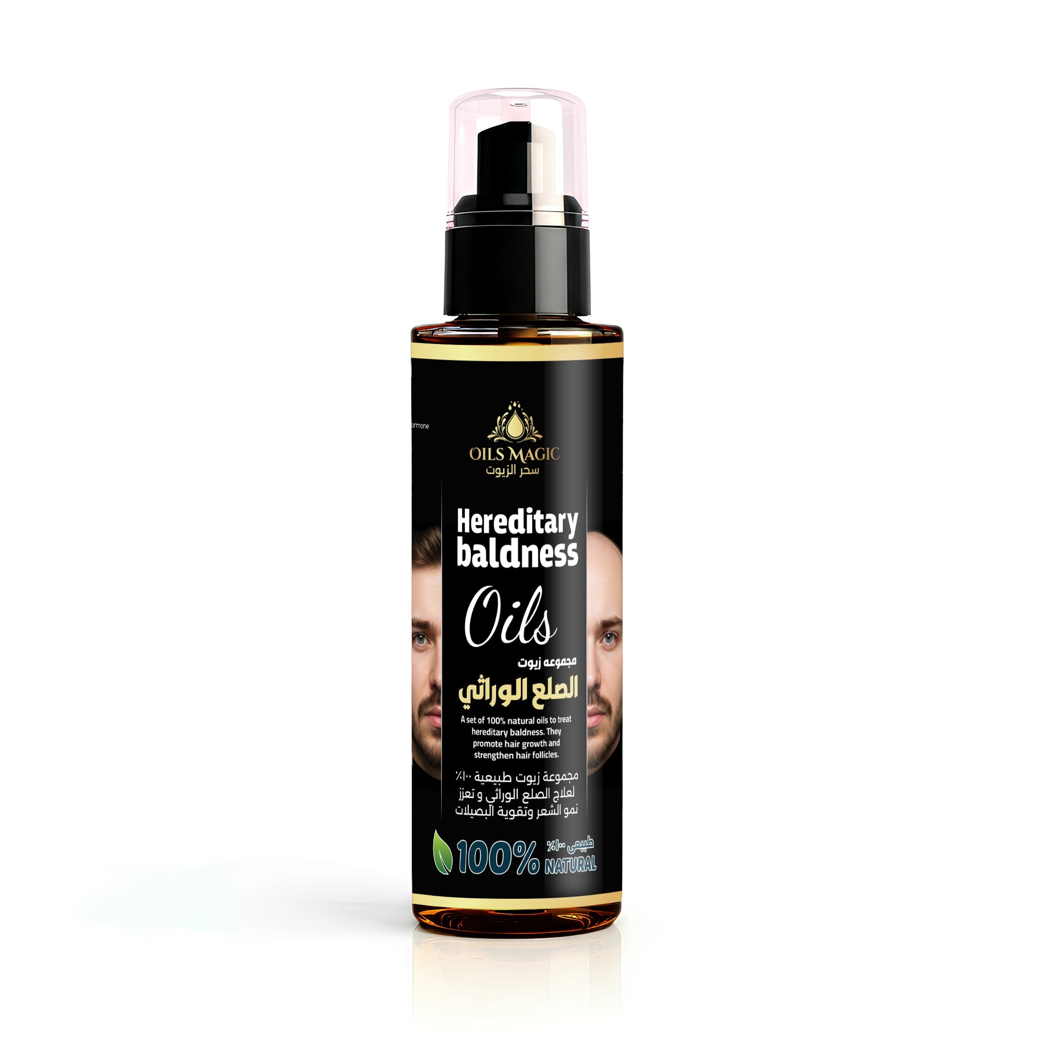 Hereditary Baldness – 100ml