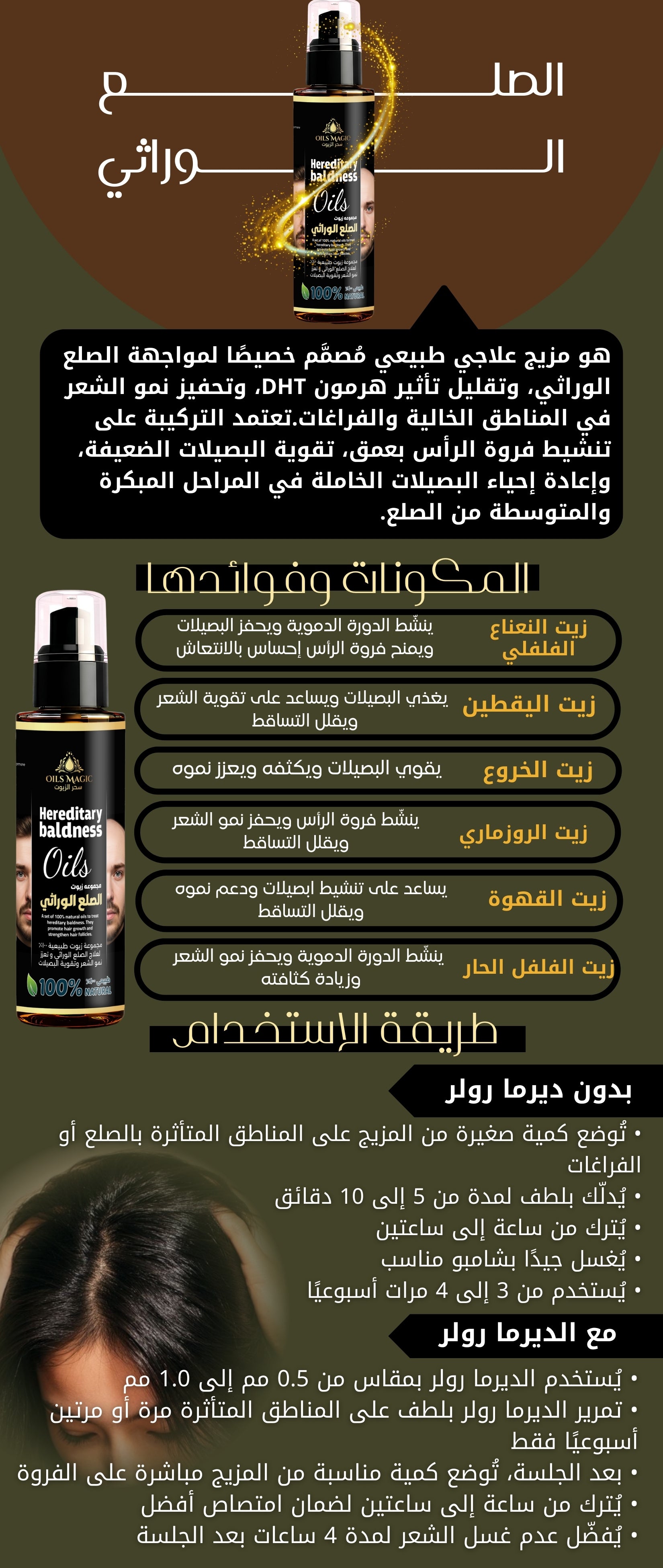 Hereditary Baldness – 100ml